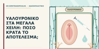 υαλουρονικό στα μεγάλα χείλη