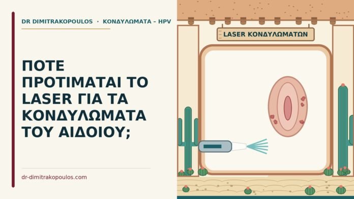 laser για κονδυλώματα