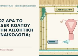 laser κόλπου
