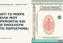 μικρά χείλη που κρέμονται