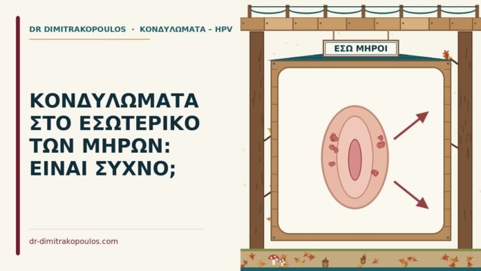 κονδυλώματα στο εσωτερικό των μηρών