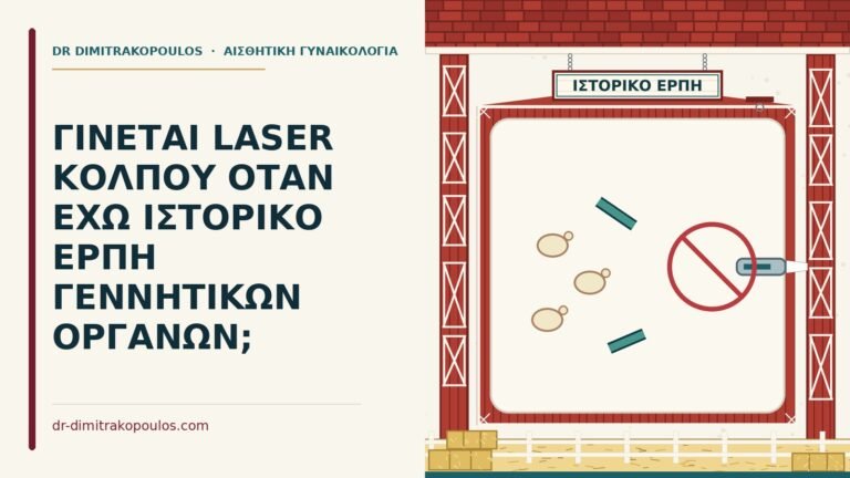 laser κόλπου