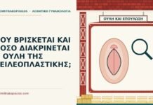 ΠΟΥ ΒΡΙΣΚΕΤΑΙ ΚΑΙ ΠΟΣΟ ΔΙΑΚΡΙΝΕΤΑΙ Η ΟΥΛΗ ΤΗΣ ΧΕΙΛΕΟΠΛΑΣΤΙΚΗΣ; ουλή χειλεοπλαστικής