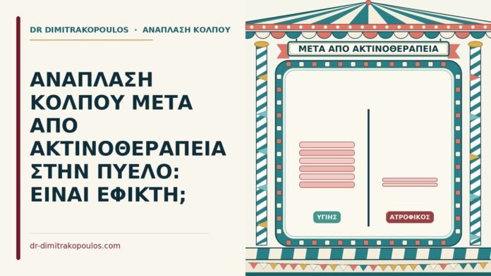 ΑΝΑΠΛΑΣΗ ΚΟΛΠΟΥ ΜΕΤΑ ΑΠΟ ΑΚΤΙΝΟΘΕΡΑΠΕΙΑ ΣΤΗΝ ΠΥΕΛΟ: ΕΙΝΑΙ ΕΦΙΚΤΗ; ανάπλαση κόλπου μετά από ακτινοθεραπεία