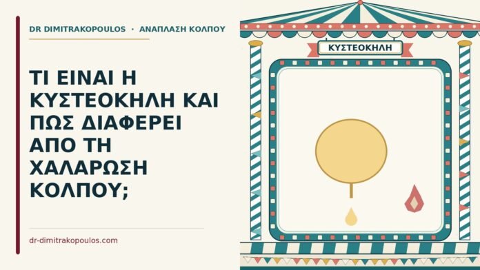 ΤΙ ΕΙΝΑΙ Η ΚΥΣΤΕΟΚΗΛΗ ΚΑΙ ΠΩΣ ΔΙΑΦΕΡΕΙ ΑΠΟ ΤΗ ΧΑΛΑΡΩΣΗ ΚΟΛΠΟΥ; κυστεοκήλη