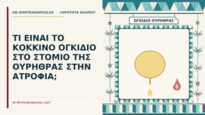 ογκίδιο στο στόμιο της ουρήθρας