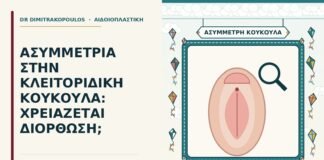 ασυμμετρία στην κλειτοριδική κουκούλα