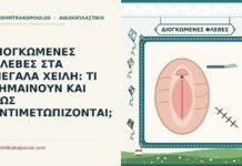 διογκωμένες φλέβες στα μεγάλα χείλη
