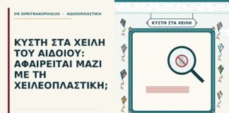 κύστη στα χείλη του αιδοίου