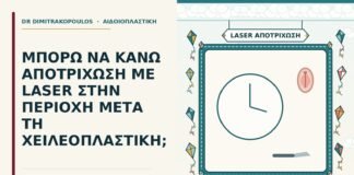 αποτρίχωση με laser μετά τη χειλεοπλαστική