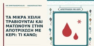μικρά χείλη ματώνουν στην αποτρίχωση με κερί