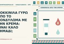 ΚΟΚΚΙΝΙΛΑ ΓΥΡΩ ΑΠΟ ΤΟ ΚΟΝΔΥΛΩΜΑ ΜΕ ΤΗΝ ΚΡΕΜΑ: ΕΙΝΑΙ ΚΑΛΟ ΣΗΜΑΔΙ; κοκκινίλα γύρω από το κονδύλωμα