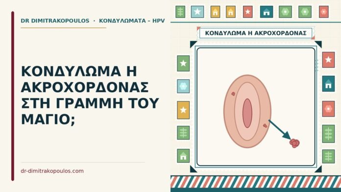 ΚΟΝΔΥΛΩΜΑ Η ΑΚΡΟΧΟΡΔΟΝΑΣ ΣΤΗ ΓΡΑΜΜΗ ΤΟΥ ΜΑΓΙΟ; κονδύλωμα ή ακροχορδόνας