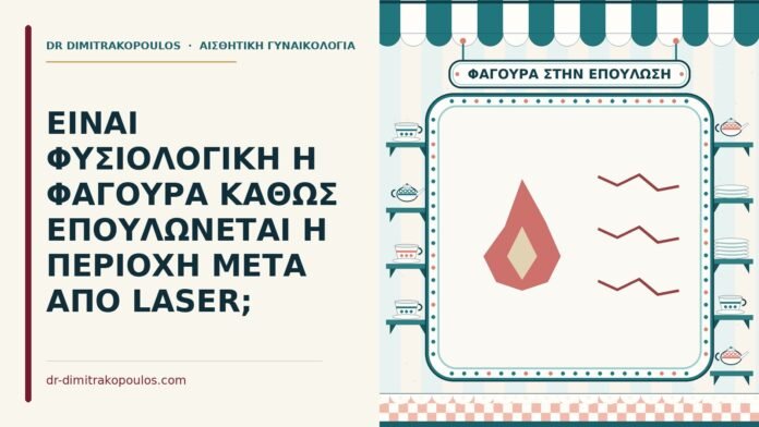 φαγούρα