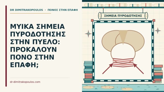 σημεία πυροδότησης