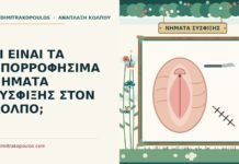 νήματα σύσφιξης