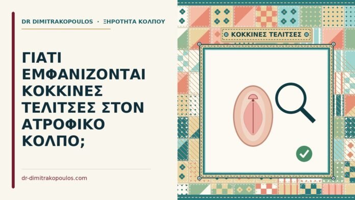 κόκκινες τελίτσες