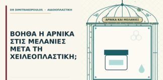 άρνικα