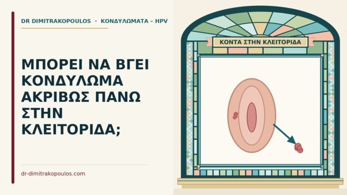 κονδύλωμα στην κλειτορίδα