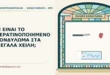 ΤΙ ΕΙΝΑΙ ΤΟ ΚΕΡΑΤΙΝΟΠΟΙΗΜΕΝΟ ΚΟΝΔΥΛΩΜΑ ΣΤΑ ΜΕΓΑΛΑ ΧΕΙΛΗ; κερατινοποιημένο κονδύλωμα