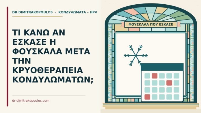 ΤΙ ΚΑΝΩ ΑΝ ΕΣΚΑΣΕ Η ΦΟΥΣΚΑΛΑ ΜΕΤΑ ΤΗΝ ΚΡΥΟΘΕΡΑΠΕΙΑ ΚΟΝΔΥΛΩΜΑΤΩΝ; φουσκάλα μετά την κρυοθεραπεία