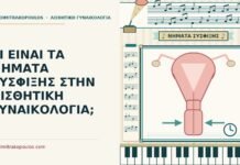 νήματα σύσφιξης