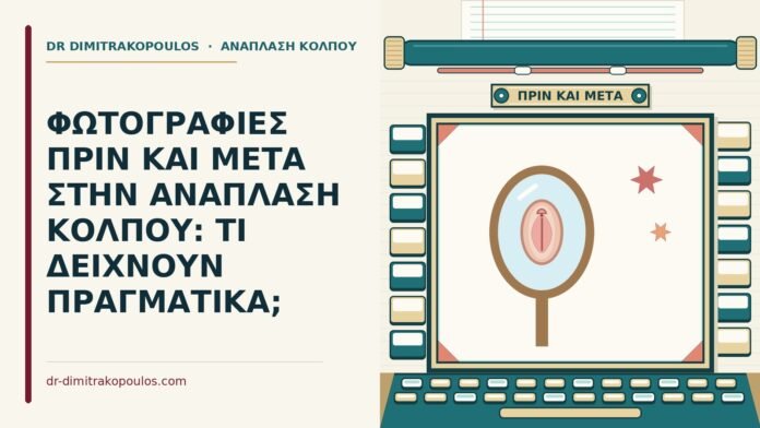 φωτογραφίες πριν και μετά