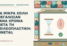 ΤΑ ΜΙΚΡΑ ΧΕΙΛΗ ΜΕΓΑΛΩΣΑΝ ΞΑΝΑ ΧΡΟΝΙΑ ΜΕΤΑ ΤΗ ΧΕΙΛΕΟΠΛΑΣΤΙΚΗ: ΓΙΝΕΤΑΙ; μικρά χείλη μετά τη χειλεοπλαστική