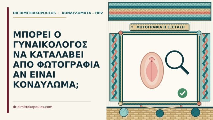 φωτογραφία του κονδυλώματος