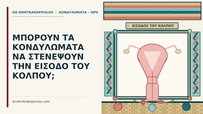 ΜΠΟΡΟΥΝ ΤΑ ΚΟΝΔΥΛΩΜΑΤΑ ΝΑ ΣΤΕΝΕΨΟΥΝ ΤΗΝ ΕΙΣΟΔΟ ΤΟΥ ΚΟΛΠΟΥ; κονδυλώματα στην είσοδο του κόλπου