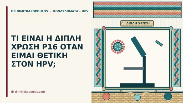 ΤΙ ΕΙΝΑΙ Η ΔΙΠΛΗ ΧΡΩΣΗ P16 ΟΤΑΝ ΕΙΜΑΙ ΘΕΤΙΚΗ ΣΤΟΝ HPV; διπλή χρώση p16
