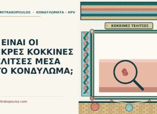 ΤΙ ΕΙΝΑΙ ΟΙ ΜΙΚΡΕΣ ΚΟΚΚΙΝΕΣ ΤΕΛΙΤΣΕΣ ΜΕΣΑ ΣΤΟ ΚΟΝΔΥΛΩΜΑ; κόκκινες τελίτσες μέσα στο κονδύλωμα