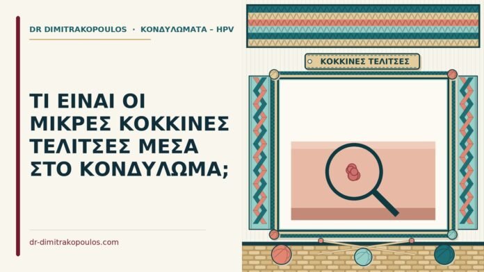 κόκκινες τελίτσες μέσα στο κονδύλωμα