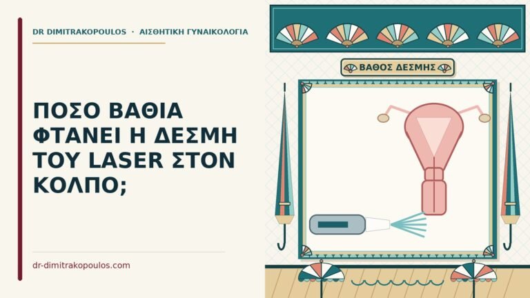 βάθος της δέσμης του laser