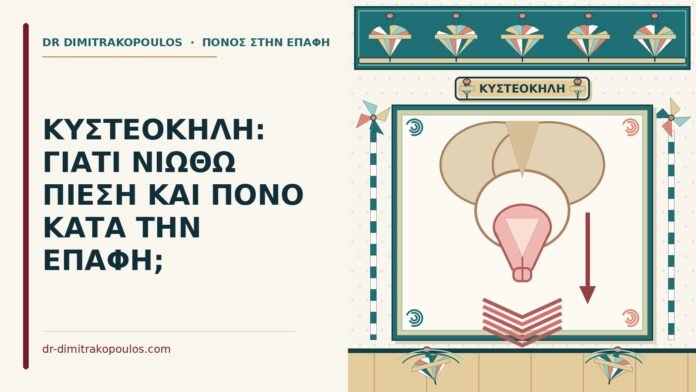 κυστεοκήλη