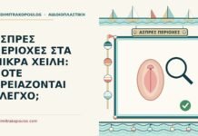 ΑΣΠΡΕΣ ΠΕΡΙΟΧΕΣ ΣΤΑ ΜΙΚΡΑ ΧΕΙΛΗ: ΠΟΤΕ ΧΡΕΙΑΖΟΝΤΑΙ ΕΛΕΓΧΟ; άσπρες περιοχές στα μικρά χείλη
