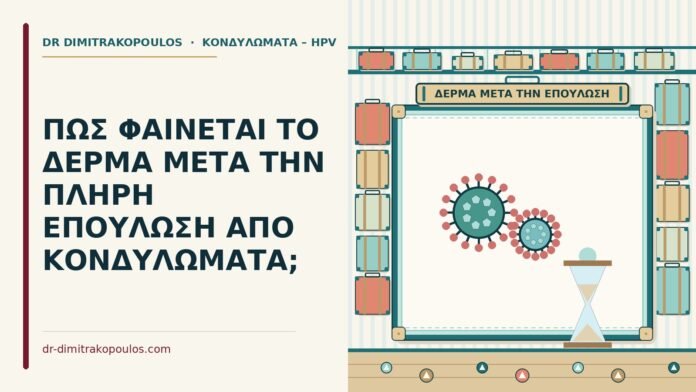 δέρμα μετά την επούλωση από κονδυλώματα