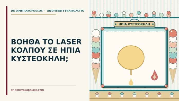 laser κόλπου σε ήπια κυστεοκήλη