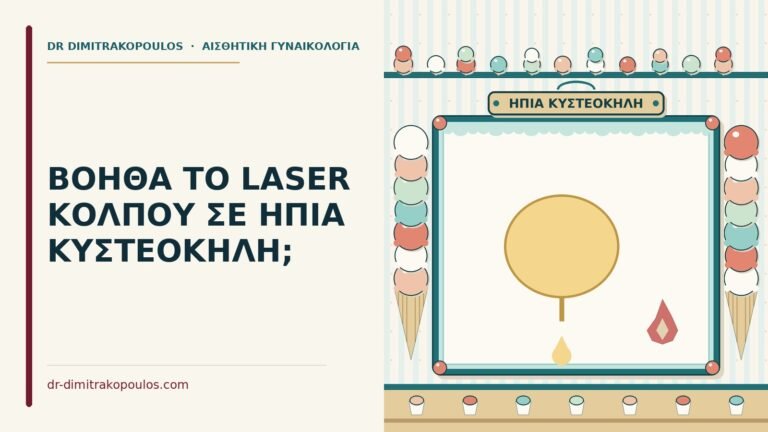 laser κόλπου σε ήπια κυστεοκήλη