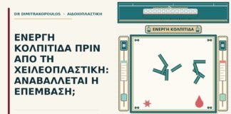 ενεργή κολπίτιδα
