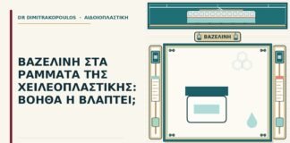 βαζελίνη