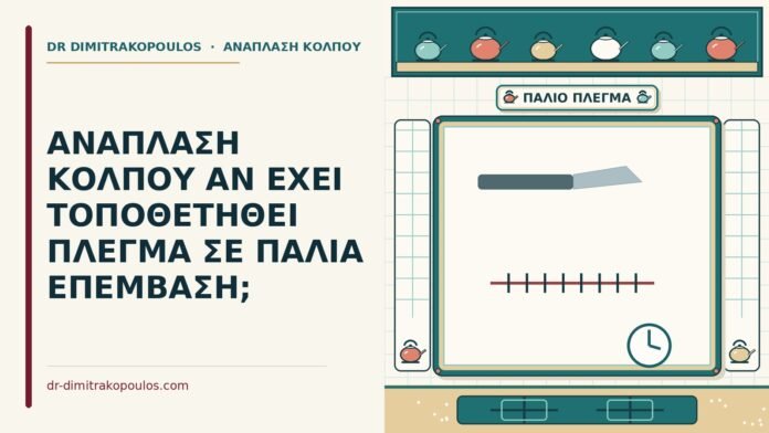 πλέγμα
