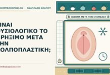 πρήξιμο