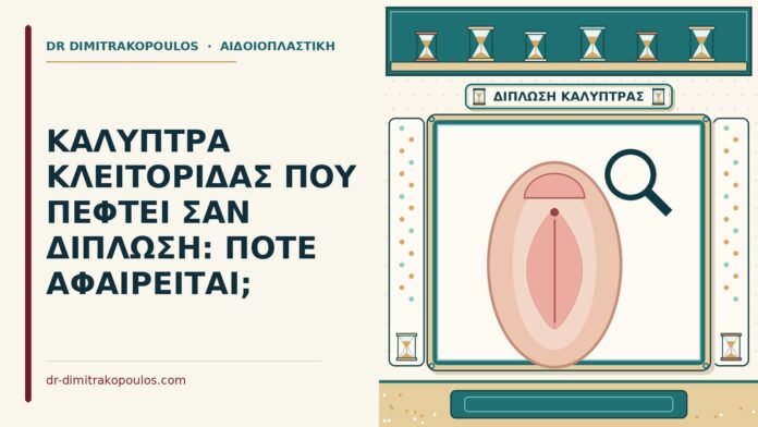 ΚΑΛΥΠΤΡΑ ΚΛΕΙΤΟΡΙΔΑΣ ΠΟΥ ΠΕΦΤΕΙ ΣΑΝ ΔΙΠΛΩΣΗ: ΠΟΤΕ ΑΦΑΙΡΕΙΤΑΙ; καλύπτρα κλειτορίδας