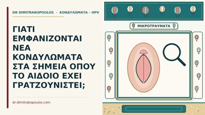 κονδυλώματα σε γρατζουνιές