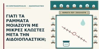 ράμματα σαν μικρές κλωστές