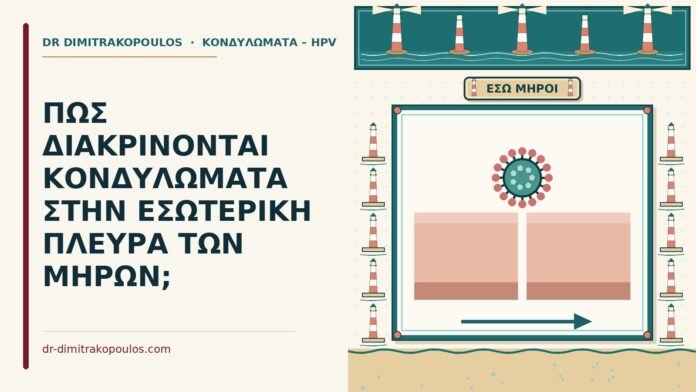 ΠΩΣ ΔΙΑΚΡΙΝΟΝΤΑΙ ΚΟΝΔΥΛΩΜΑΤΑ ΣΤΗΝ ΕΣΩΤΕΡΙΚΗ ΠΛΕΥΡΑ ΤΩΝ ΜΗΡΩΝ; εσωτερική πλευρά των μηρών
