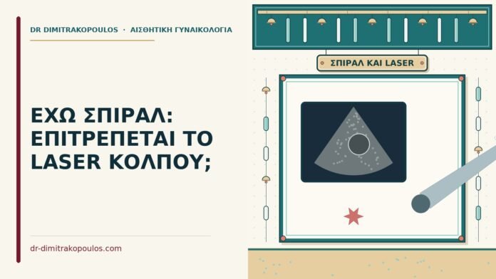 laser κόλπου με σπιράλ