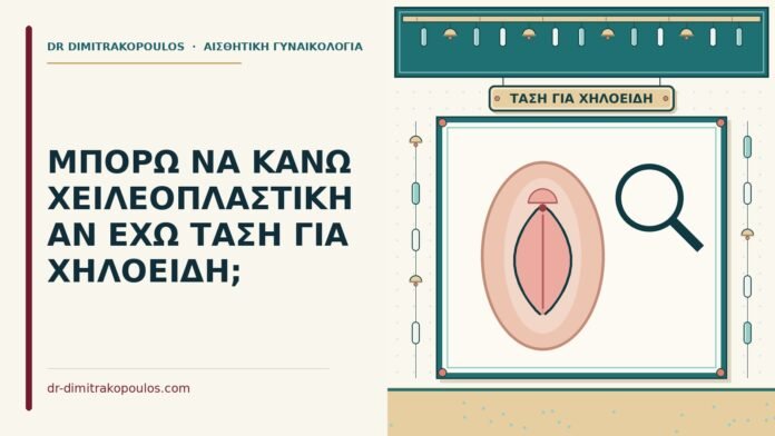 ΜΠΟΡΩ ΝΑ ΚΑΝΩ ΧΕΙΛΕΟΠΛΑΣΤΙΚΗ ΑΝ ΕΧΩ ΤΑΣΗ ΓΙΑ ΧΗΛΟΕΙΔΗ; χηλοειδή