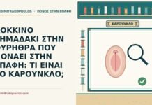 ΚΟΚΚΙΝΟ ΣΗΜΑΔΑΚΙ ΣΤΗΝ ΟΥΡΗΘΡΑ ΠΟΥ ΠΟΝΑΕΙ ΣΤΗΝ ΕΠΑΦΗ: ΤΙ ΕΙΝΑΙ ΤΟ ΚΑΡΟΥΝΚΛΟ; καρούνκλο της ουρήθρας
